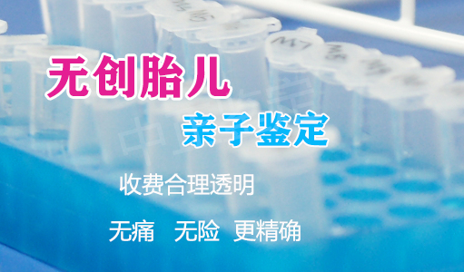 河北怀孕亲子鉴定收费多少钱,河北产前亲子鉴定如何做 河北怀孕亲子鉴定收费多少钱,河北产前亲子鉴定如何做